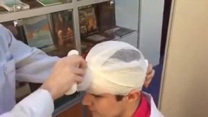 Повязка «Шапочка Гиппократа» двумя