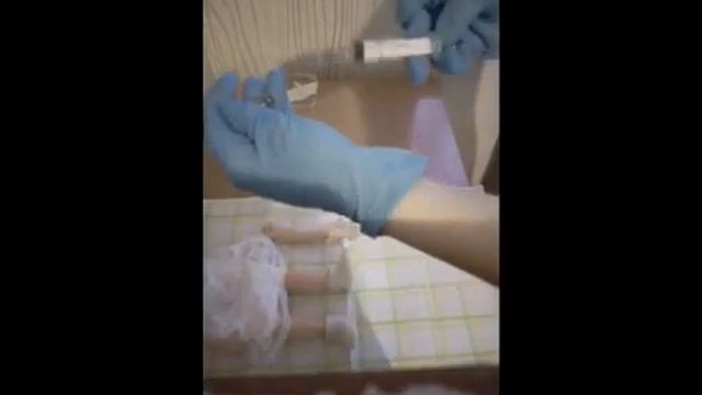 Внутрикожная инъекция