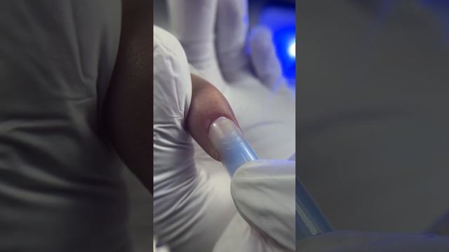 ПРИЧИНЫ ГРЯЗНОГО ОТПЕЧАТКА при работе с верхними формами смотреть онлайн