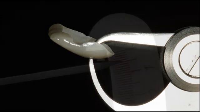 Керамические виниры. Porcelain veneers. Emax. Carillas Dentales.