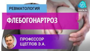 Профессор Щеглов Э.А.: Флебогонартроз