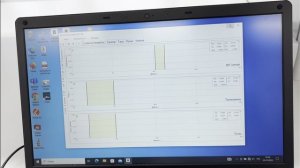 Электроокулография