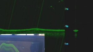 Эхолот FPV Kotello visor