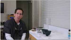 Точные альгинатные оттиски и гипсовые модели.