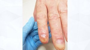 С чего подологу начать обучение?