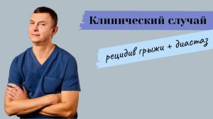 КЛИНИЧЕСКИЙ СЛУЧАЙ ГРЫЖА+ДИАСТАЗ//ПЛИКАЦИЯ ВЕРХНЕЙ БРЮШНОЙ СТЕНКИ