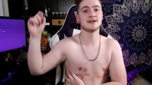 2 Months Post Op Top Surgery Update #4 // FTM Transgender