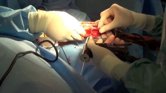 Dog Patellar Luxation and Patella Alta Repair At Southpaws Specialist Veterinary Hospital