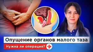 Опущение органов малого таза: кому грозит, всегда ли нужна операция, как ее сделать бесплатно по ОМС