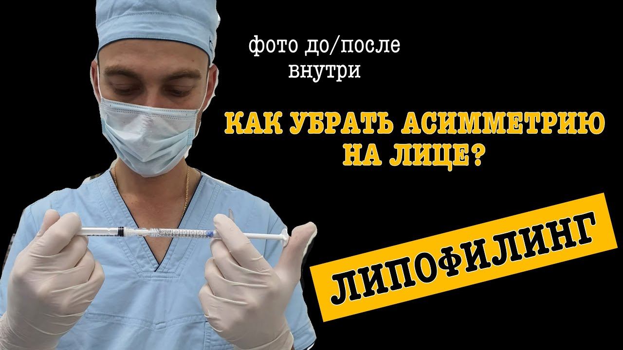 АСИММЕТРИЯ ЛИЦА. Как я исправил асимметрию лица навсегда