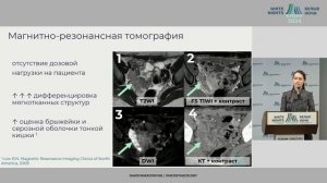 Рак яичника - что хочет знать хирург от радиолога / #WNOF2024