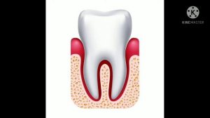 TUSHDA TİSH KO'RSA NİMA BO'LADİ?
