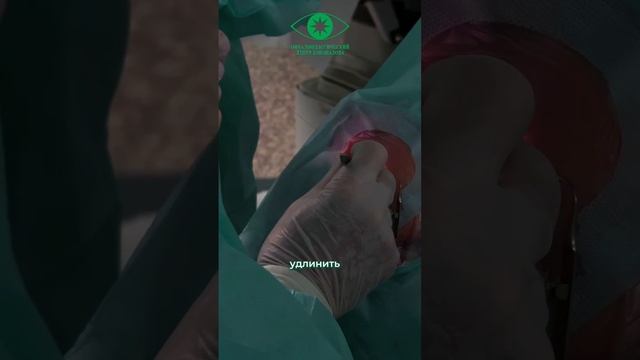 Исправление косоглазия хирургической операцией