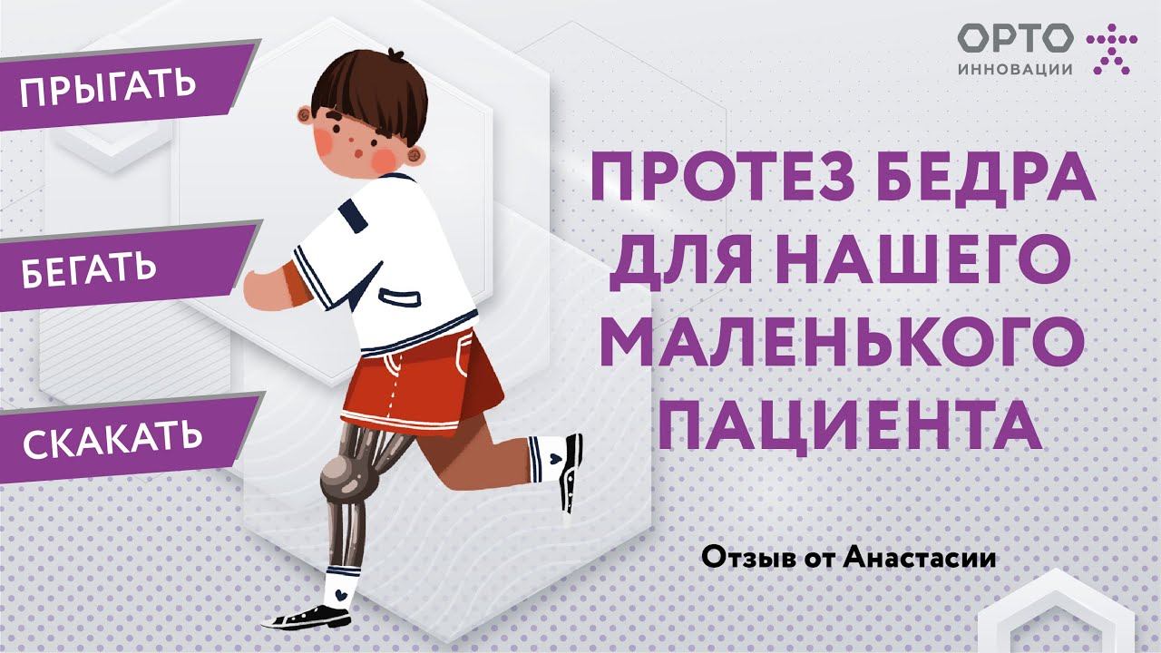 Детское протезирование, протез бедра модульный для нашего активного пациента
