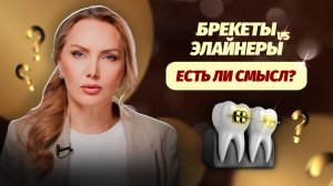 Можно ли НАВСЕГДА сохранить результат после брекетов и элайнеров?