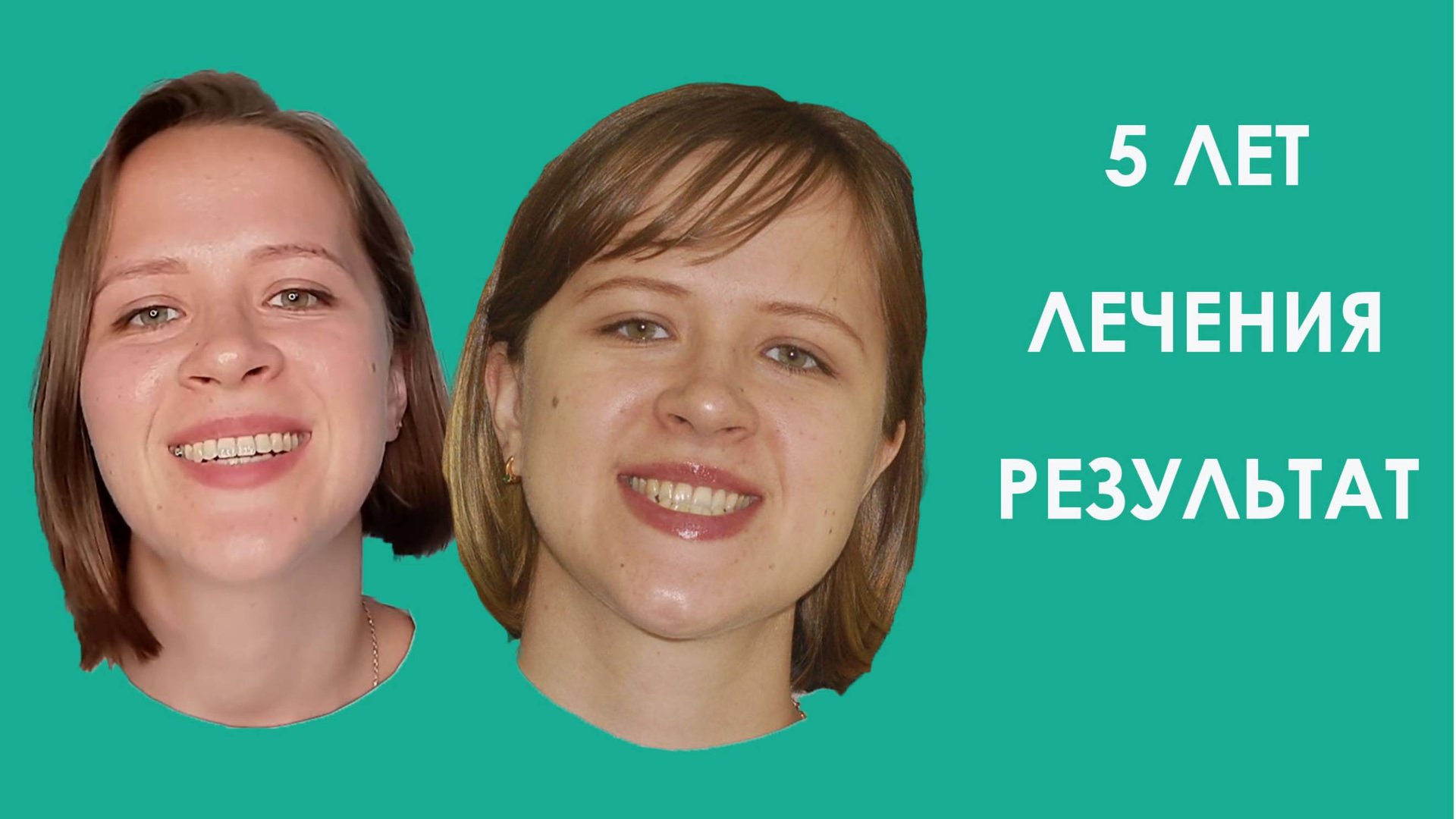5 лет ЛЕЧЕНИЯ. Результат