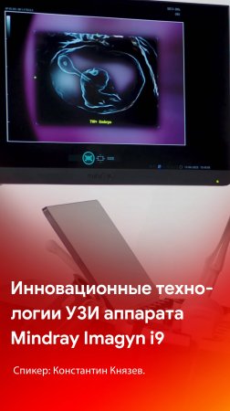 Инновационные технологии ультразвуковой системы Mindray Imagyn i9