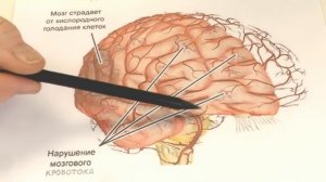 Шум в голове у пожилых: причины и лечение шума в ушах у пожилых