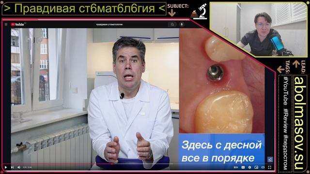 Правдивая стоматология у проф. Аболмасов Н.Н. - Часть 86 "Критерии успешной установки имплантатов!"