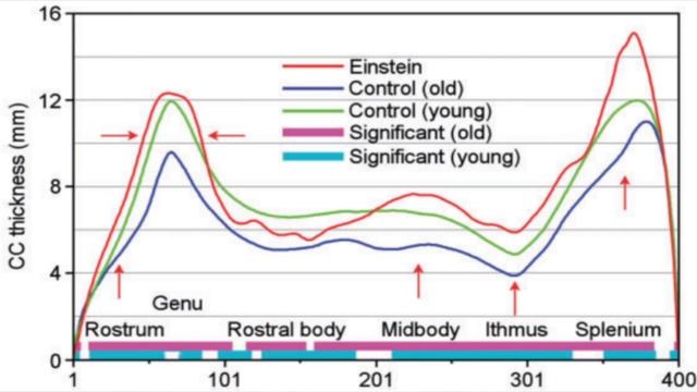 Einstein's ENORMOUS Brain смотреть онлайн
