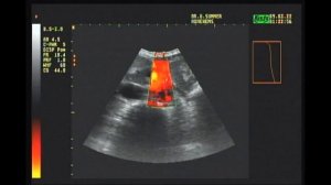 Узи Кишечника.