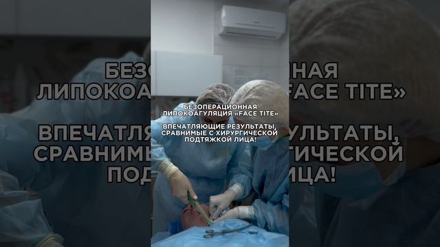 БЕЗОПЕРАЦИОННАЯ ЛИПОКОАГУЛЯЦИЯ “FACE TITE”💥