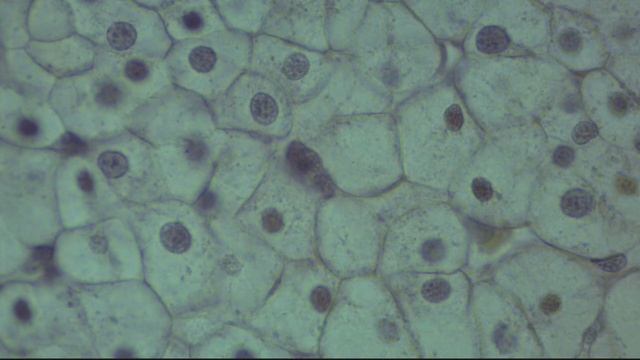 Гистологиялық препаратты талдау: Көпбұрышты жануарлар клеткасы (бауыр). Г.Э. смотреть онлайн
