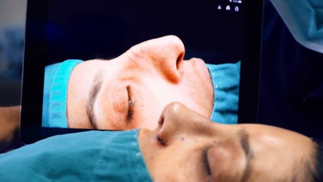 Ultrasonic Rinoplasti (Ультразвуковая ринопластика)