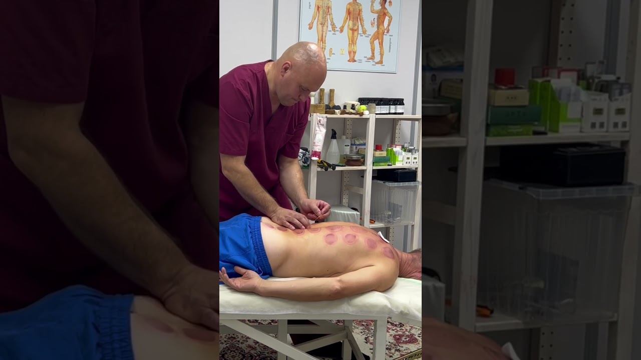 ASMR операция «иглонож» Ростов на Дону 89614113110 #acupuncture #traditionalchinesemedicine #asmr