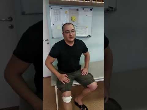 ОТЗЫВ ОБ АРТРОСКОПИИ КОЛЕННОГО СУСТАВА