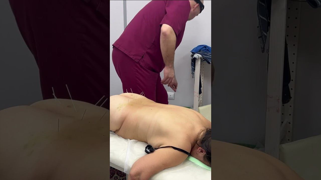 ASMR ставим иголки Ростов на Дону 89614113110 #traditionalchinesemedicine #chiropractic #asmr