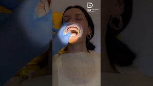 Ортодонтическое лечение на элайнерах.