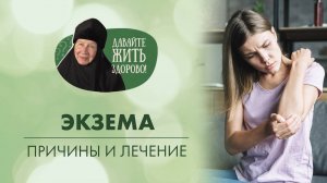 Экзема. Причины заболевания и как лечить экзему? «Давайте жить здорово!»