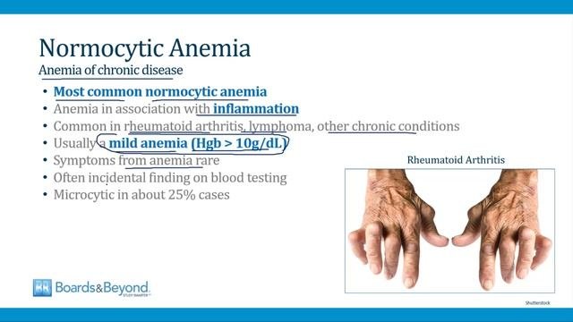 1.Normocytic Anemias
