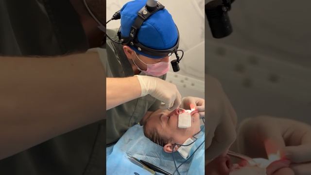 Резекция ДАО. Консультация 89653237788.