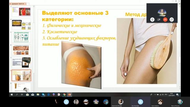 Целлюлит - причины и способы устранения. Яна Титаренко