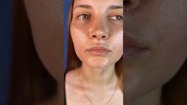 Малая хирургия с большим результатом Буллхорн.