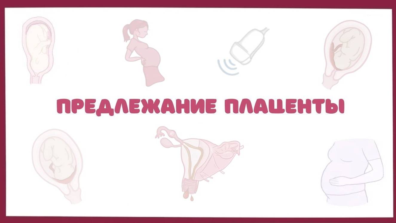 Предлежание плаценты - причины, симптомы, лечение (акушерство) лекция