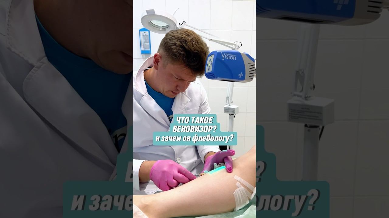 ВЕНОВИЗОР — Прибор, помогающий рассмотреть даже самые незаметные венки #флеболог #веновизор смотреть онлайн