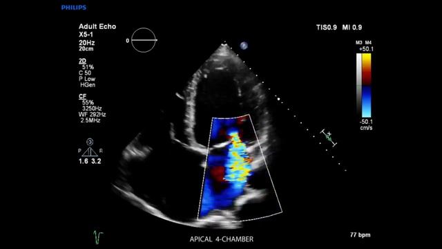 Philips EPIQ смотреть онлайн