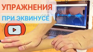 Эквинусная походка | Упражнения для длинной малоберцовой мышцы