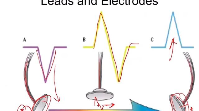 ECG Basics 3 Conduction System of Heart | #vlog 5# смотреть онлайн