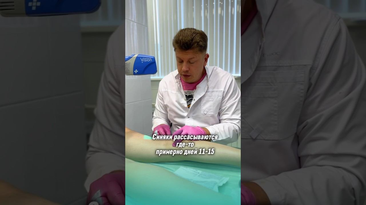 Склеротерапия глюкозой ✨ В чем основные отличия и преимущества #флеболог #варикоз #склеротерапия смотреть онлайн