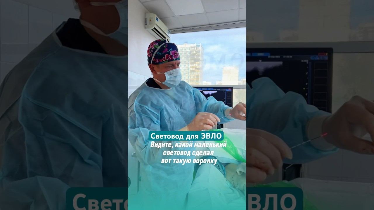 Этот эффективный и безопасный метод удаляет крупные и мелкие притоки. Немецкий световод Biolitec смотреть онлайн