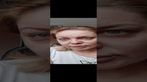 ретинол 0,2% , 2 месяца применения