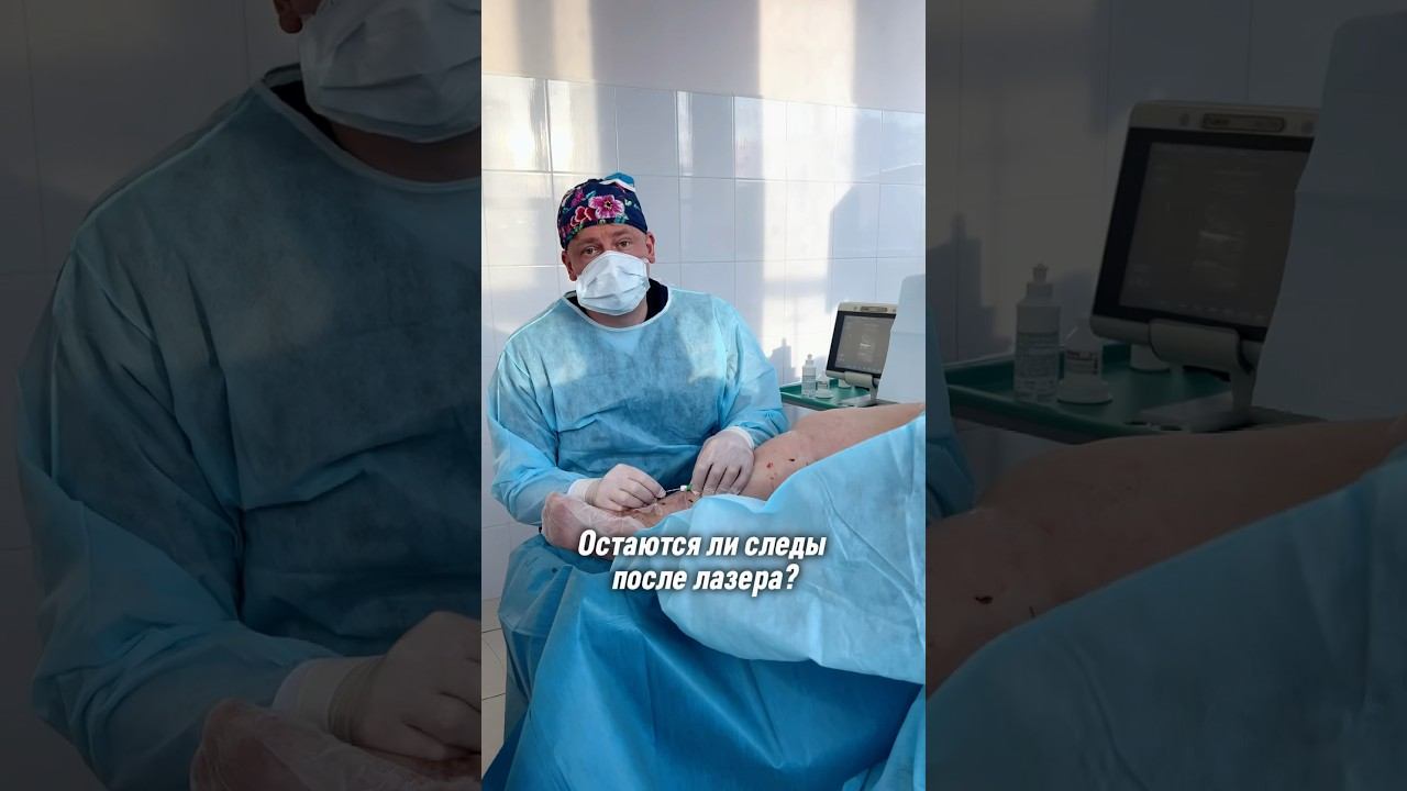 Остаются ли следы после ЭВЛО? #варикоз #флеболог #склеротерапия #лечениеварикоза #эвло смотреть онлайн