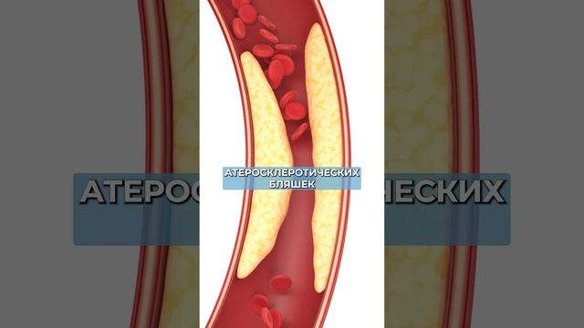 Добавьте ЭТО в питание для очистки сосудов! #здоровье #сосуды #питание смотреть онлайн