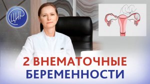 2 внематочные беременности - в чём причина? Отвечает врач акушер-гинеколог ЦИР, Тимофеева О. В.