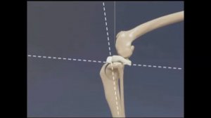 Техника TPLO