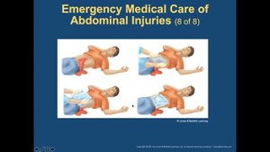 ARES EMT Class B121 - Abdominal and Genitourinary Injuries